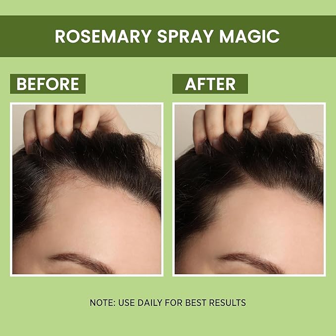 ALPS Organic Rosemary Water | Hair Spray For Growth | Hair Growth Expert 100 ml